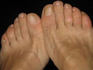 Amateur Feet Toes Soles