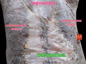 The rectus sheath is an example of connective fascia