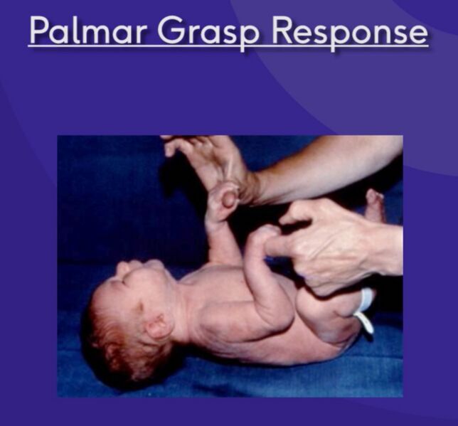 File:Palmar grasp response.jpg