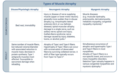 Muscle atrophy type.png