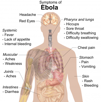 Symptoms of ebola.png