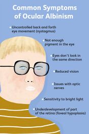 Ocular-albinism-5201966 final rev-2a520b29d6fe41e98ee71f27c82ba674.jpg