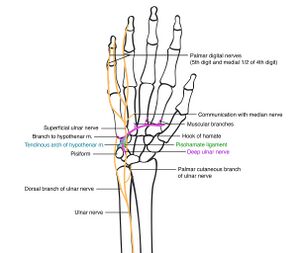 Role of Electrodiagnosis in Ulnar Nerve Entrapments - Physiopedia