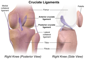 A posterior cruciate ligament szakadás - Homorú-domború lencse
