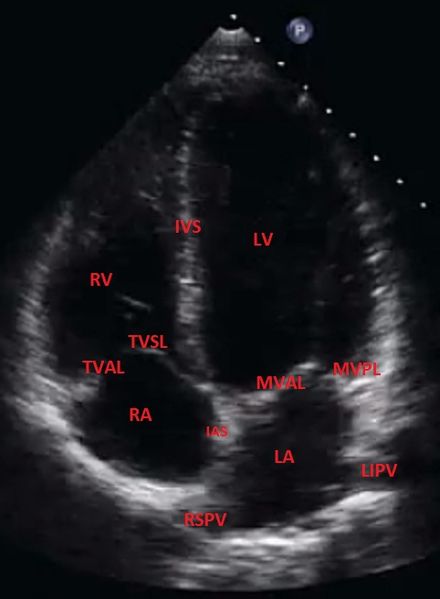 File:Apical-4-chamber-view-normal-transthoracic-echocardiography.jpeg