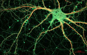 Rat Hippocampal Neuron.jpg