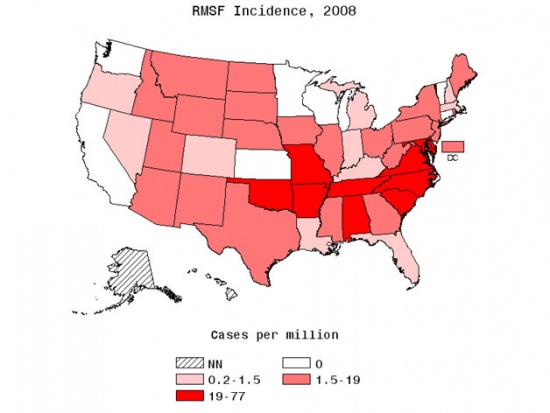 photo courtsey of: http://www.cdc.gov/rmsf/stats/