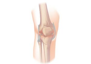 Knee osteoarthritis image.jpg
