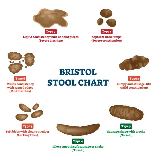 File:Bristol stool chart.jpeg