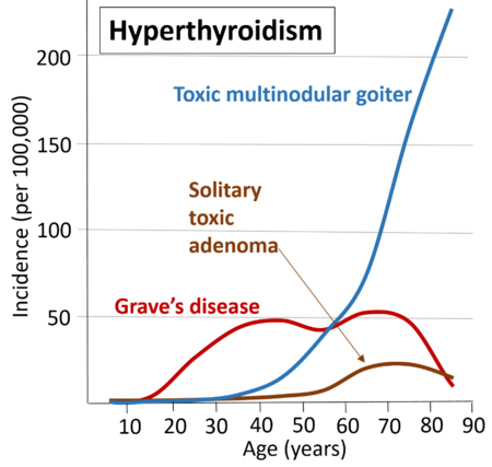 Hyperthyroidism Levels Chart
