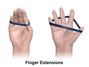 Exercise Finger Extensions.png