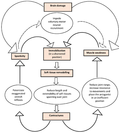 Theoretical model of events contributing to the development of contractures after acquired brain inj.png
