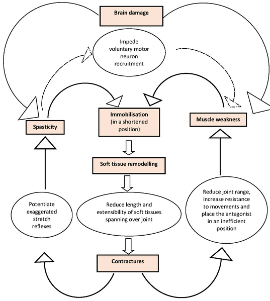 File:Theoretical model of events contributing to the development of contractures after acquired brain inj.png