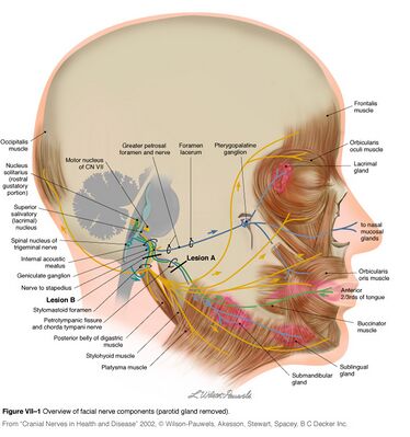 Motor points of face for electrical stimulation of bell's palsy