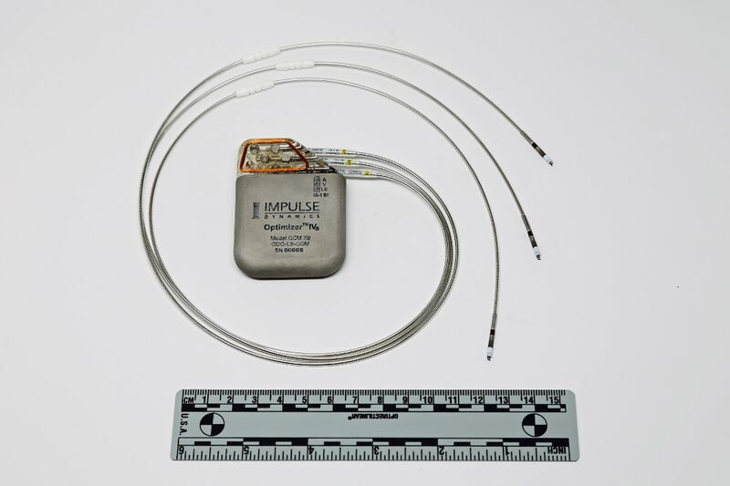 File:Implantable Pulse Generator and Leads.jpg