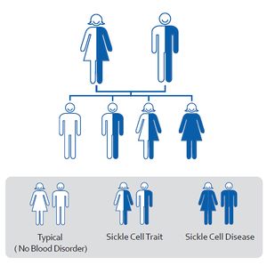 Sickle Cell Anemia inheritance model.jpg