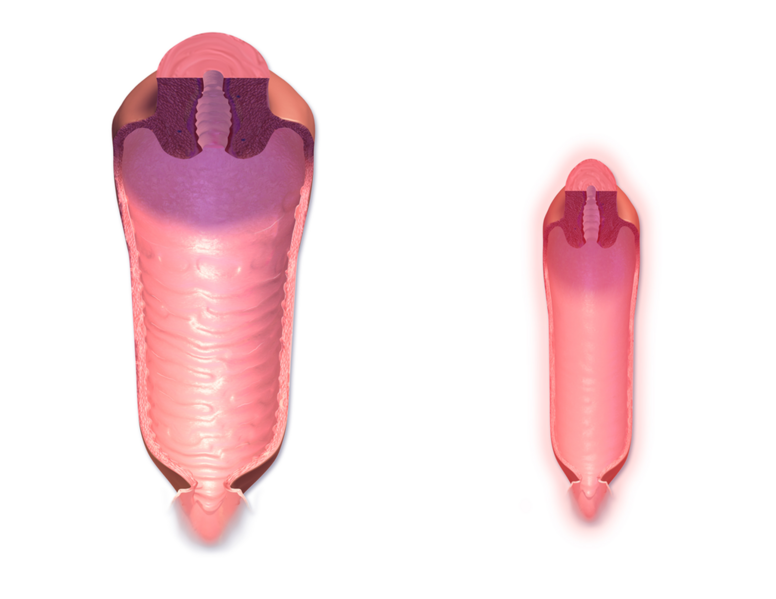 File:Vaginal Canal Normal vs. Menopause.png