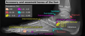 Accessory and sesamoid bones of the foot - lateral projection.jpg