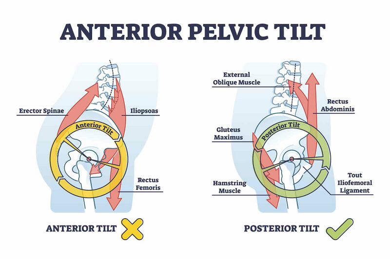 File:Anterior and posterior pelvic tilt shutterstock 1952124109.jpg