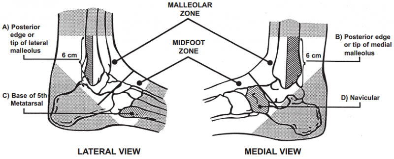 File:Ottawa ankle rules.png