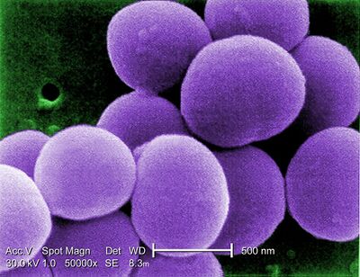 Staphylococcus aureus bacteria turns immune system against itself