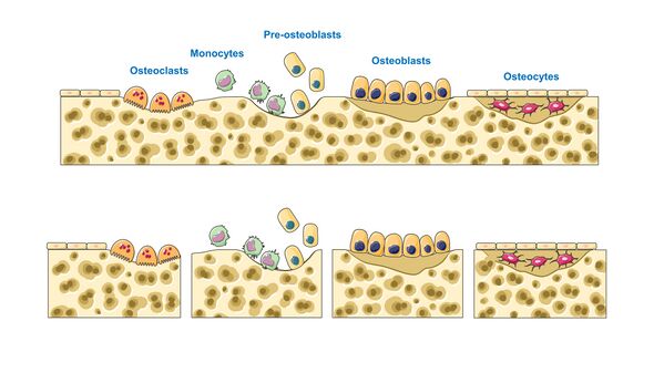 Bone regeneration - Bone remodeling cycle III - Osteoclasts Monocytes Pre-osteoblasts etc -- Smart-Servier (cropped).jpeg