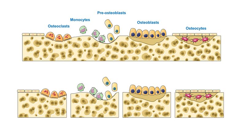File:Bone regeneration - Bone remodeling cycle III - Osteoclasts Monocytes Pre-osteoblasts etc -- Smart-Servier (cropped).jpeg