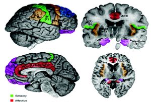 Schematic of cortical areas involved with pain processing and fMRI cropped.jpg