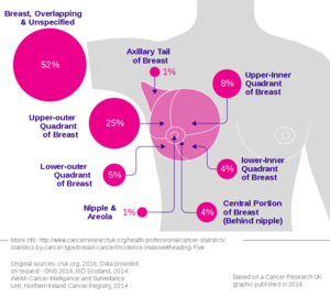 Breast cancer incidence by anatomical site (females).svg.png
