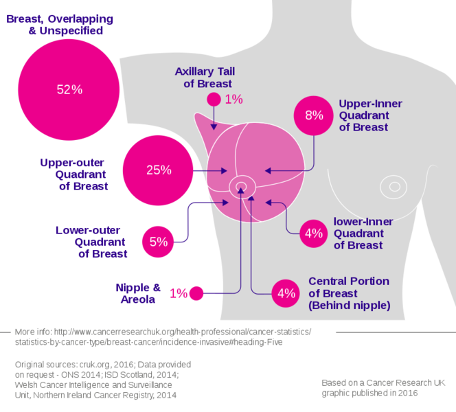 File:Breast cancer incidence by anatomical site (females).svg.png