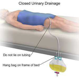 Closed Urinary Drainage.png