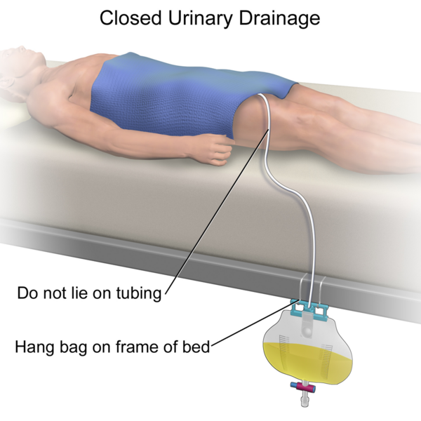 File:Closed Urinary Drainage.png