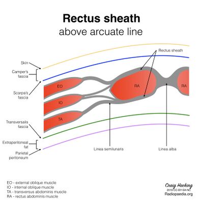 Rectus-sheath-diagram.jpeg