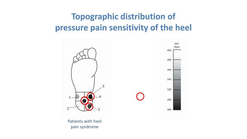 File:Topographic distribution of pressure pain sensitivity Saban 2016.jpg