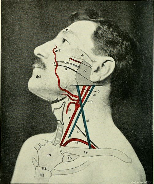 File:Carotid artery.jpg