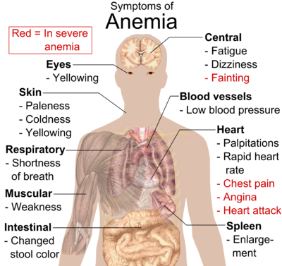 Symptoms of anemia.png