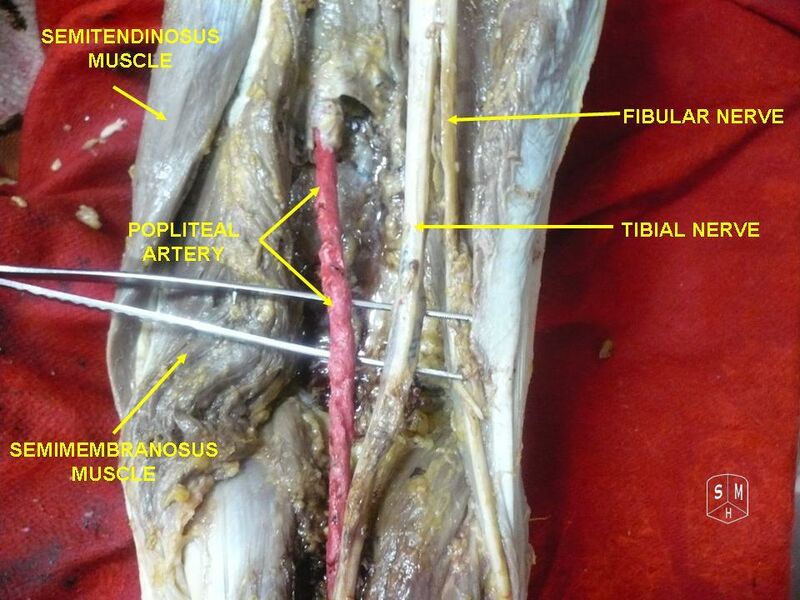 File:Tibial and fibular nerve.jpg