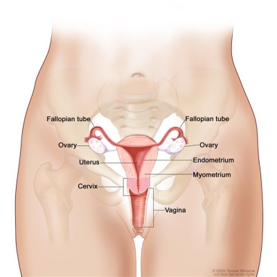 Ovarian cancer.jpg