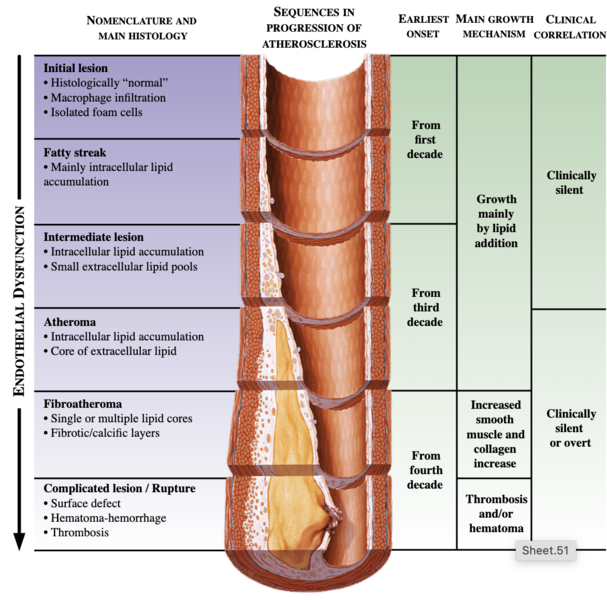 File:Endothelial dysfunction.png