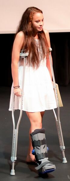 File:Me on crutches.jpg
