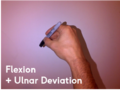 Flexion/Ulnar deviation