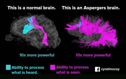 Asperger vs normal brain.jpg
