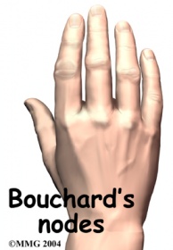 Bouchard's.jpg