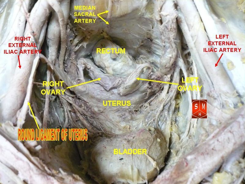 File:Round ligaments of uterus.jpg