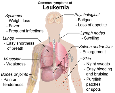 Leukemia.png