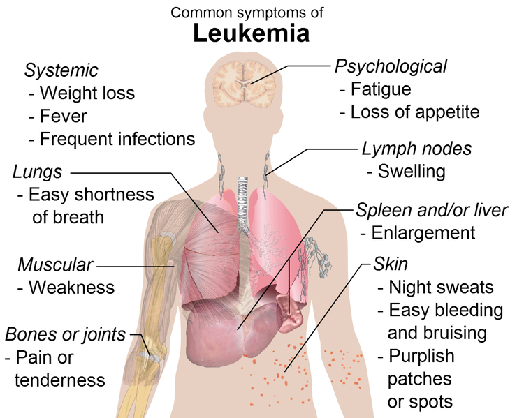 File:Leukemia.png