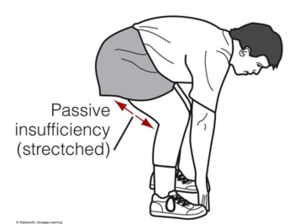Passive insufficiency of the hamstrings.png