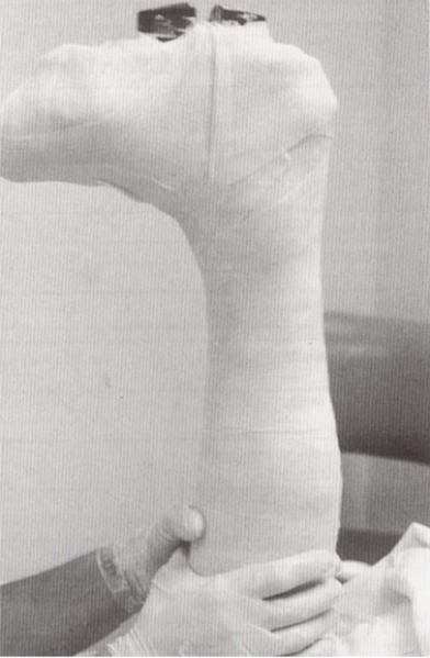 File:Total contact cast.png