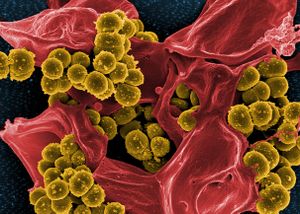 Scanning electron micrograph of Methicillin-resistant Staphylococcus aureus (MRSA) and a dead Human neutrophil - NIAID.jpg