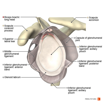 Illustration of SLAP II lesion.png